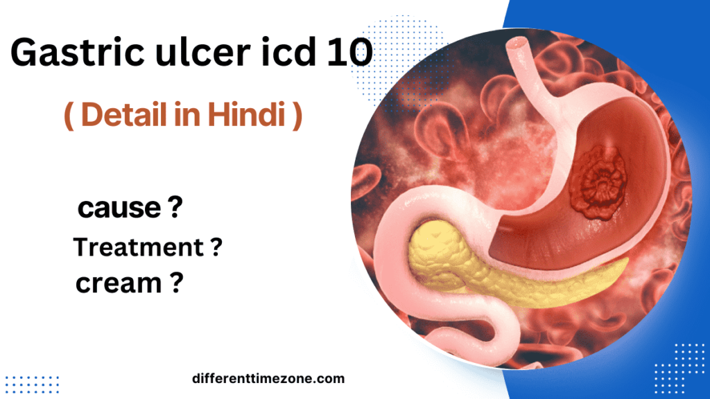 Gastric ulcer icd 10 (Hindi) 2024