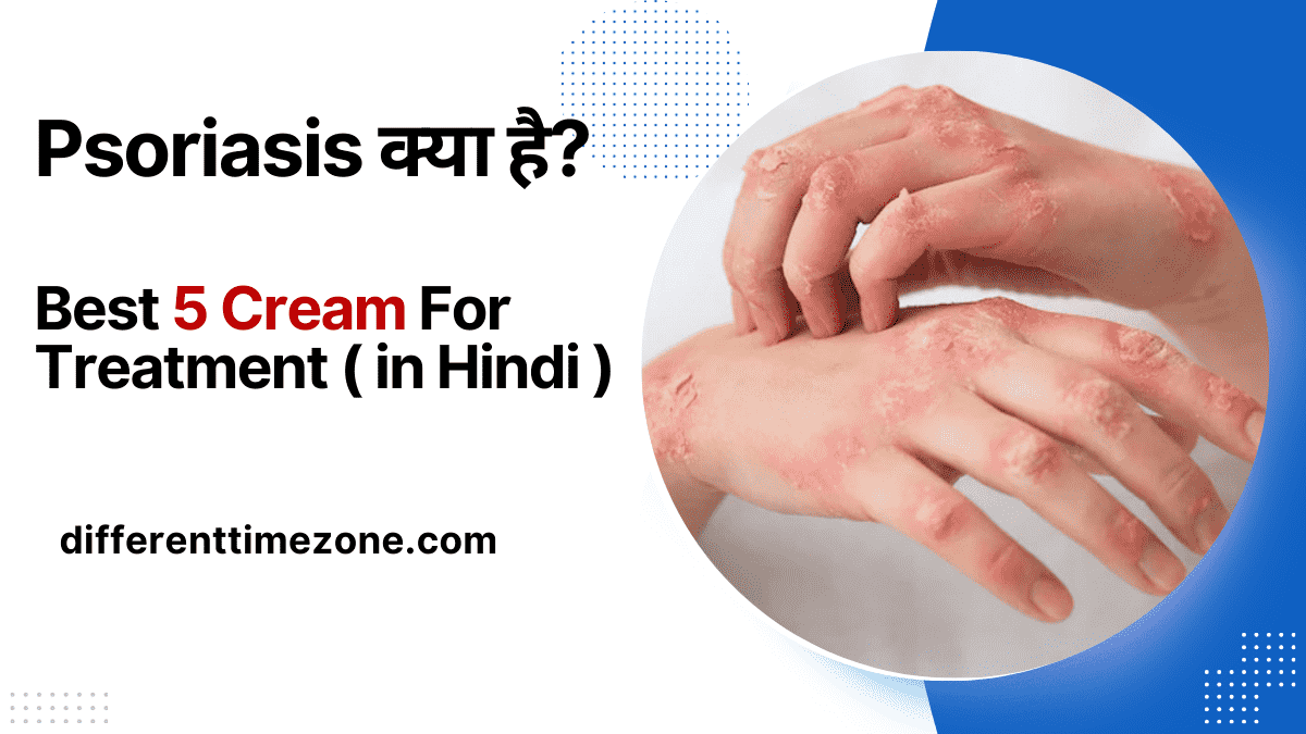 Psoriasis Kya Hai? & Best 5 Cream For Treatment ( in Hindi )