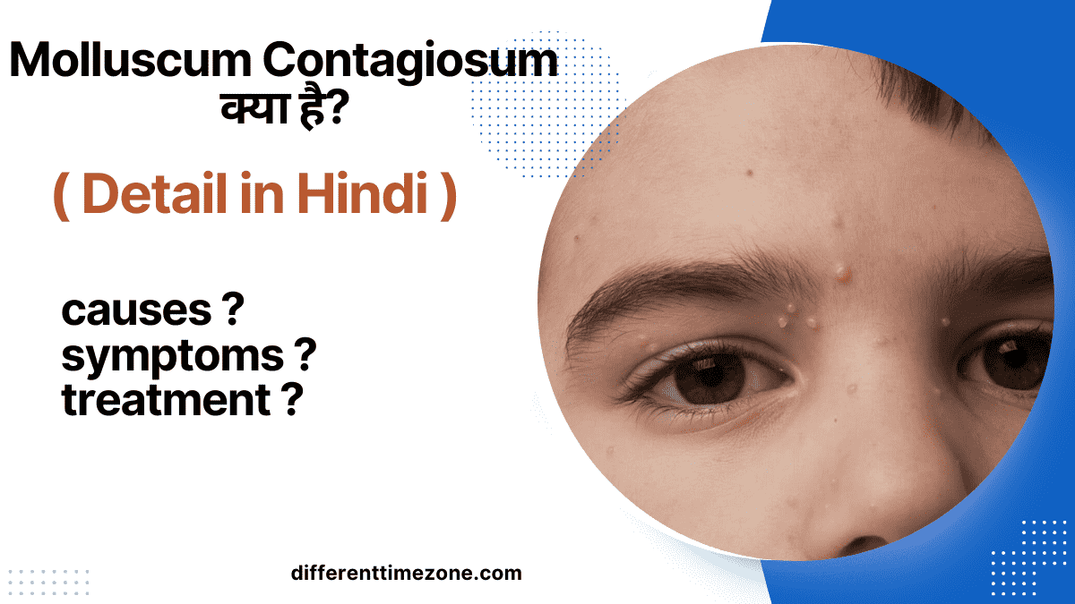 Molluscum Contagiosum Best Treatment (in Hindi)2024