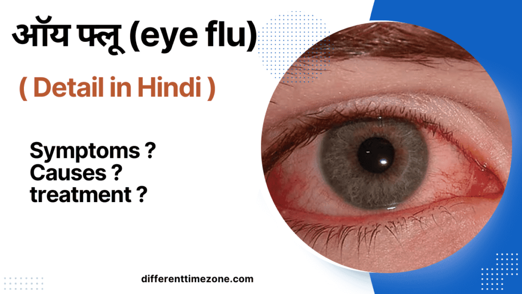 1 आंख लाल हो गया है क्या करें? ऑय फ्लू (eye flu) 2024