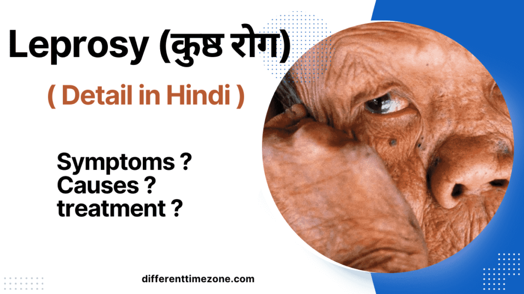 Symptoms of Leprosy (in Hindi) 2024