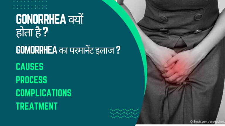 Gonorrhea सुजाक रोग का पक्का घरेलू इलाज क्या है ? 2024