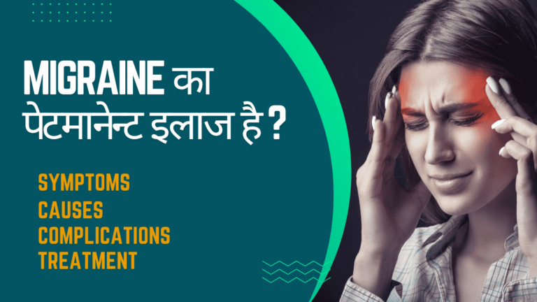 migraine का पेटमानेन्ट इलाज है ?