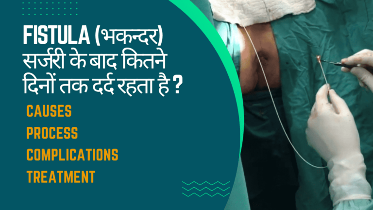 Fistula (भकन्दर) सर्जरी के बाद कितने दिनों तक दर्द रहता है ?