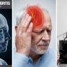 Giant Cell Arteritis क्या है? लक्षण, कारण, और उपचार